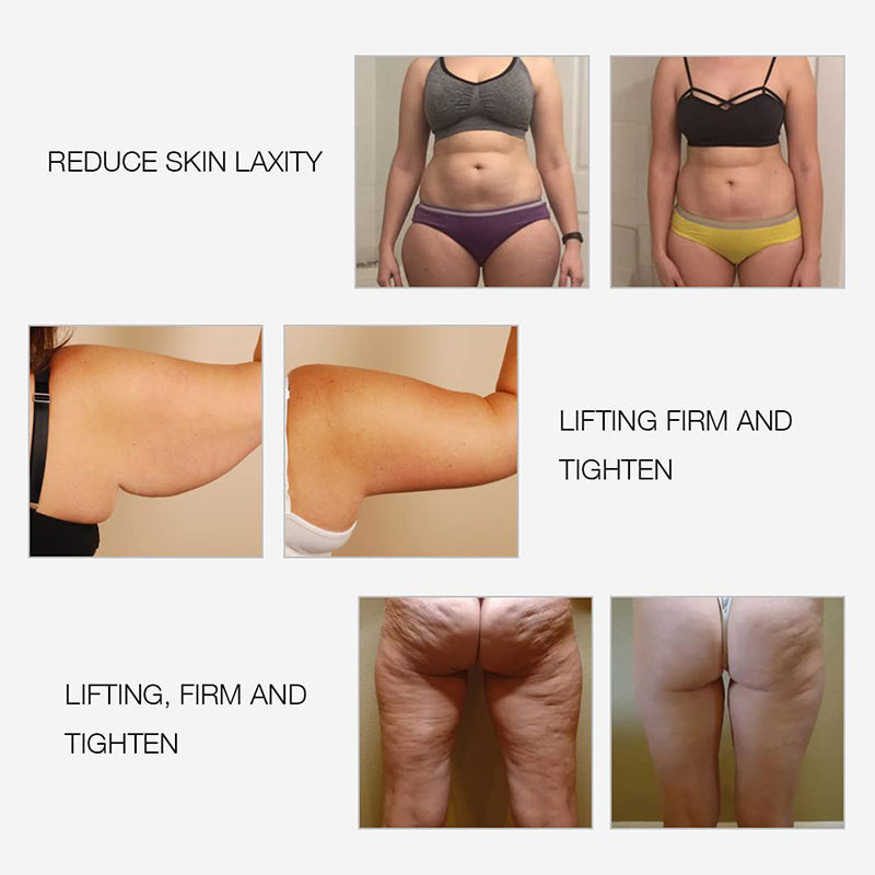 EMS Anti Cellulite Massager