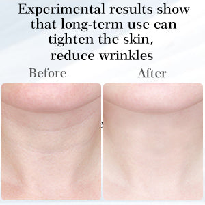 EMS Neck Lifting Device