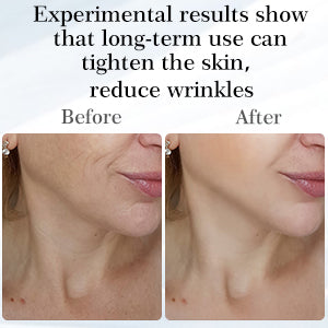 EMS Neck Lifting Device