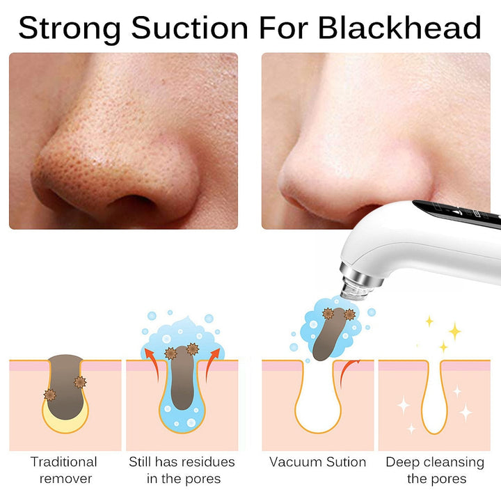 Pore Vacuum Blackhead Remover