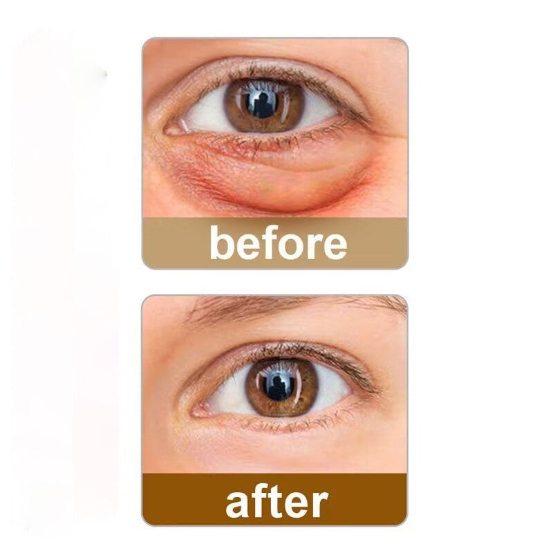 Retinol Eye Cream Stick